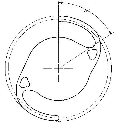 6448030-眼内レンズ 図000014