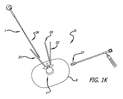 6475762-複数の脊椎外科的経路システムおよび方法 図000014