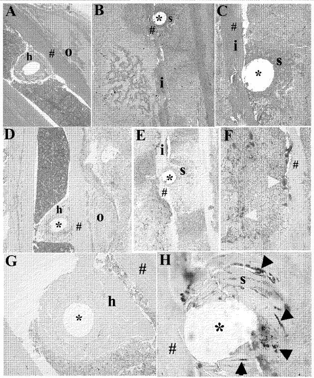 6559302-黄色ブドウ球菌（Ｓｔａｐｈｙｌｏｃｏｃｃｕｓ  ａｕｒｅｕｓ）感染症に対する抗グルコサミニダーゼ受動免疫処置 図000014