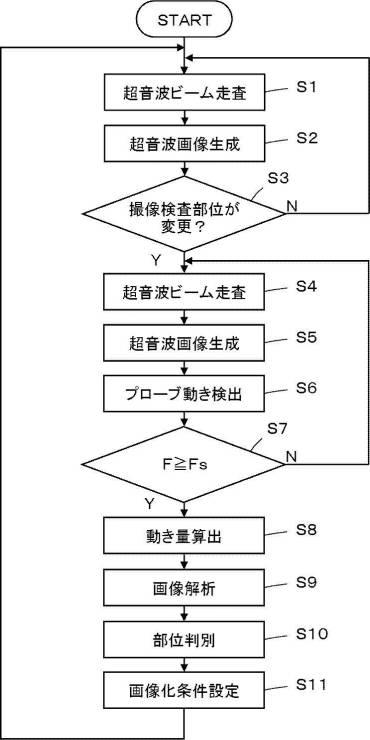 6625759-超音波診断装置および超音波診断装置の制御方法 図000014