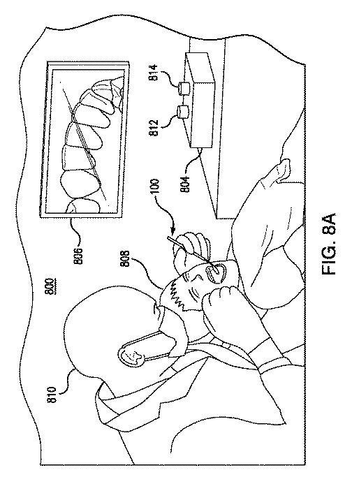 6905540-統合されたカメラを有する歯科ミラーおよびそのアプリケーション 図000014