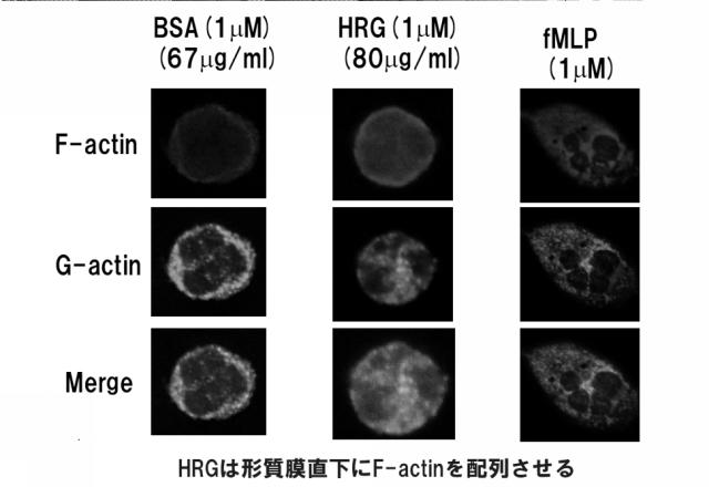 5807937-好中球活性化に起因する疾患の治療薬、治療方法及び検査方法 図000015