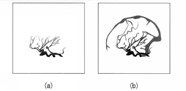 5835912-医用画像診断装置および医用画像処理装置 図000015