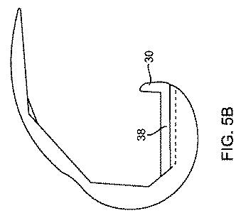 5837876-人工膝患者に深膝屈曲能力を提供するシステム及び方法 図000015