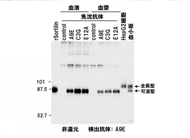 5852433-ソルチリンによる動脈硬化の判定方法 図000015