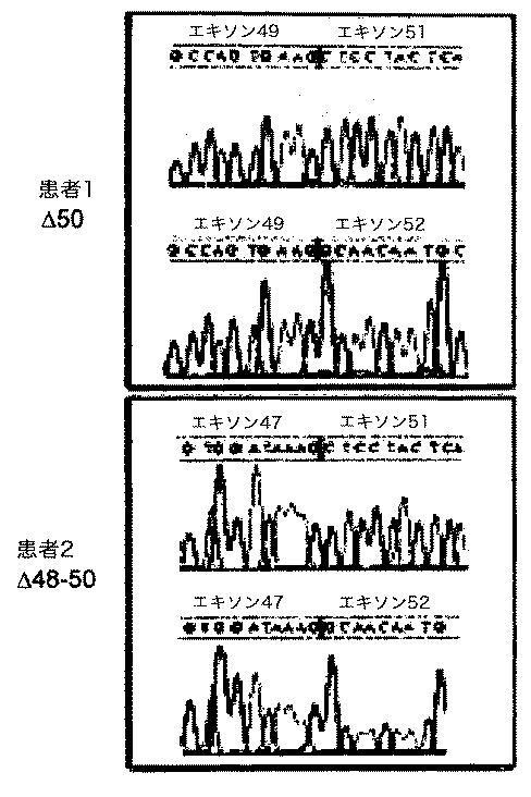 5879374-筋障害を相殺するための手段と方法 図000015