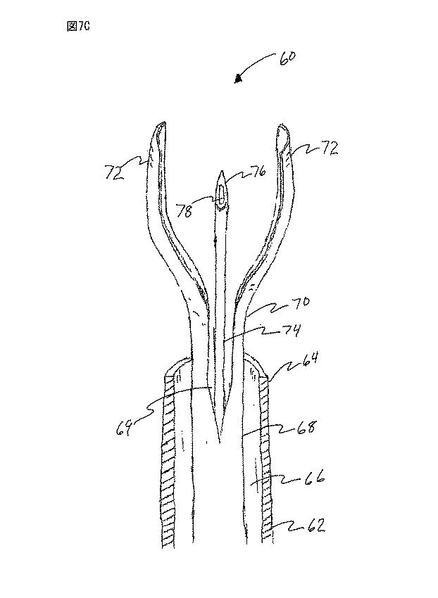 6235672-粘膜下医療処置を実行するための方法及びシステム 図000015