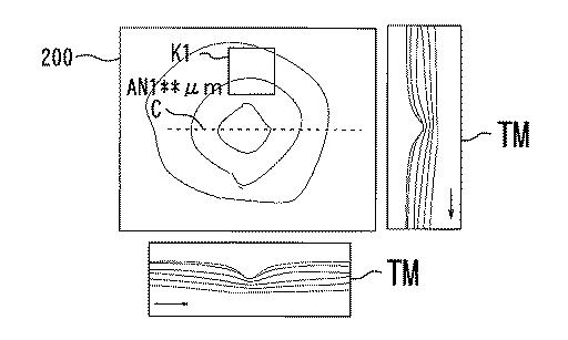 6241040-眼科解析装置、及び眼科解析プログラム 図000015