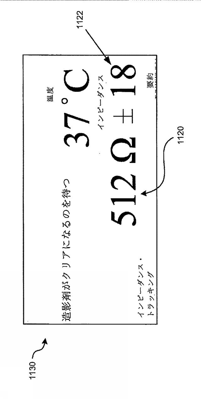 6267774-神経変調療法の評価及びフィードバックのためのデバイス、システム、及び方法 図000015