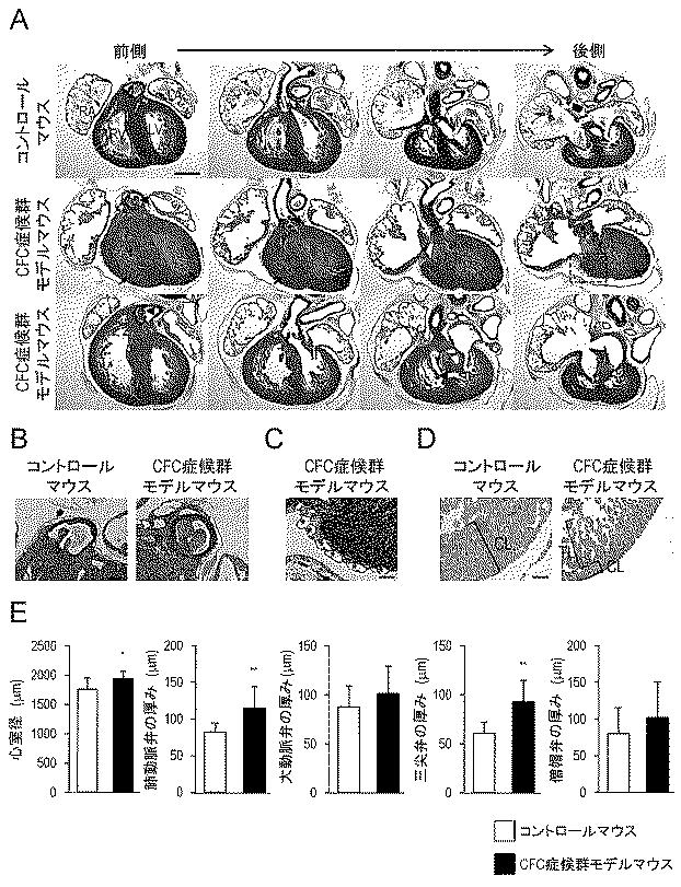 6429306-ＣＦＣ症候群モデルマウスの作製とその治療法の確立 図000015