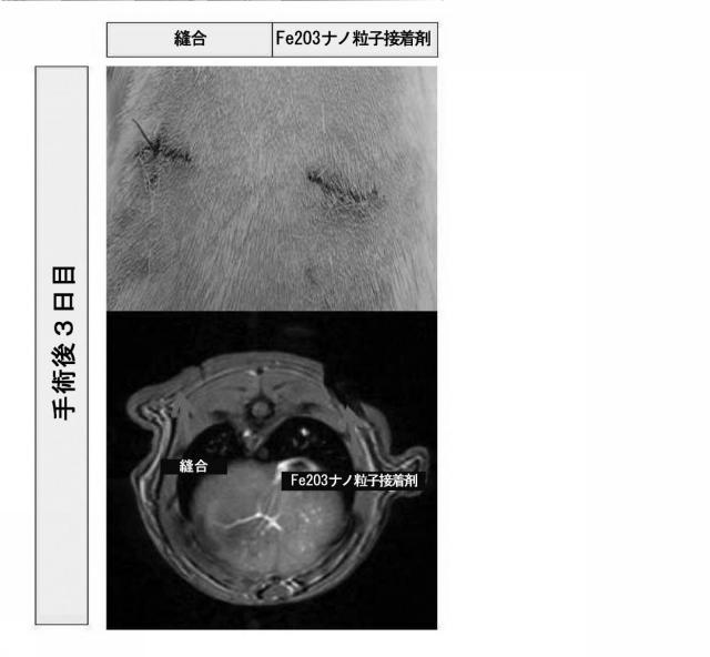 6437552-組織表面及び材料を接着する方法、並びにその生物医学的使用 図000015