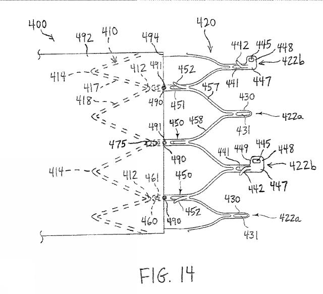 6441297-ステント及びステントグラフト 図000015