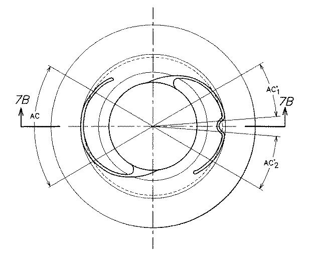 6448030-眼内レンズ 図000015