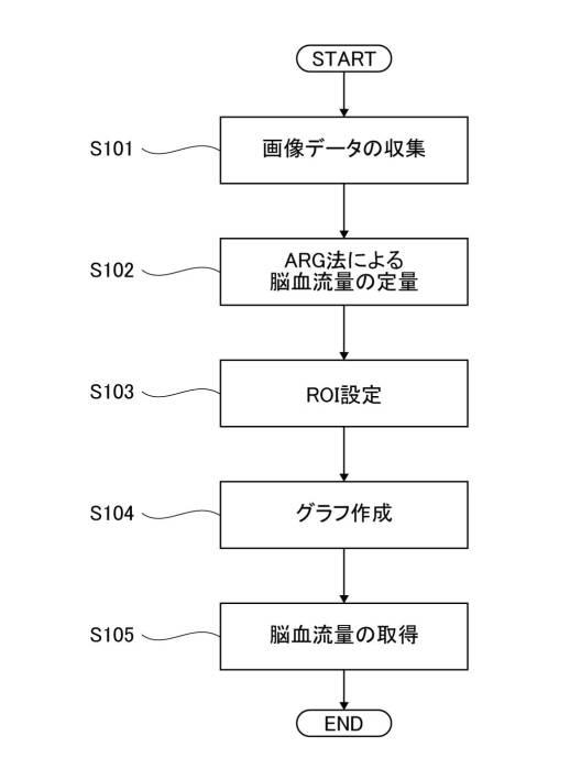 6948217-脳血流量定量方法、脳血流量定量プログラム及び脳血流量定量装置 図000015