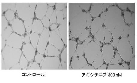 6952980-血管新生阻害薬 図000015