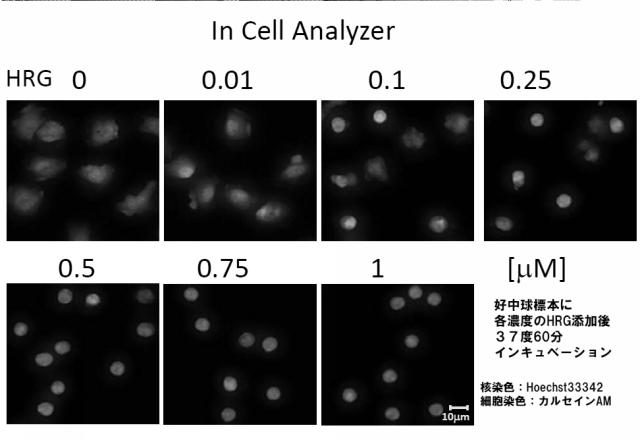 5807937-好中球活性化に起因する疾患の治療薬、治療方法及び検査方法 図000016