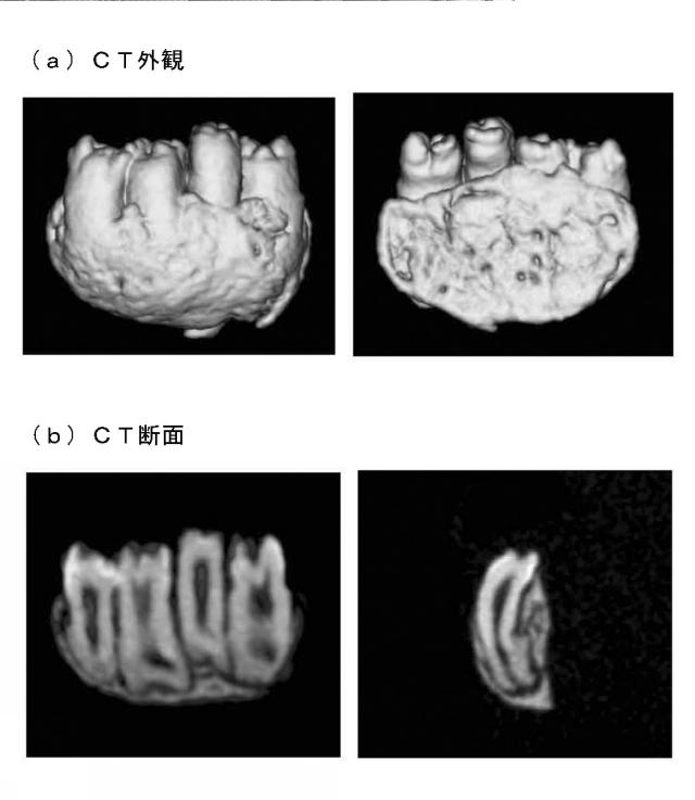 5868844-再生歯ユニットの製造方法 図000016