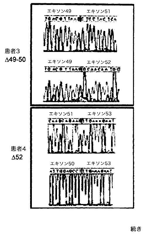 5879374-筋障害を相殺するための手段と方法 図000016