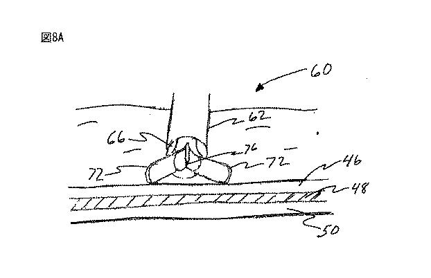 6235672-粘膜下医療処置を実行するための方法及びシステム 図000016