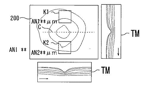 6241040-眼科解析装置、及び眼科解析プログラム 図000016