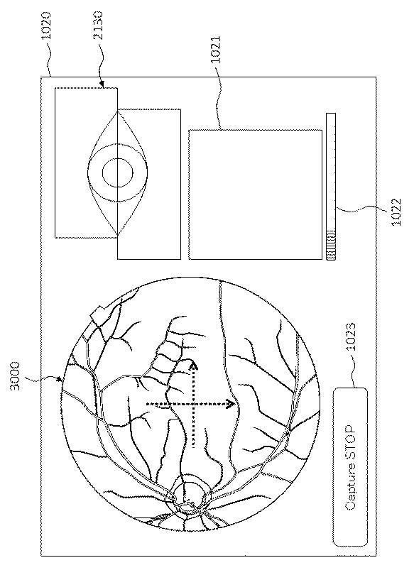 6321430-眼科装置 図000016