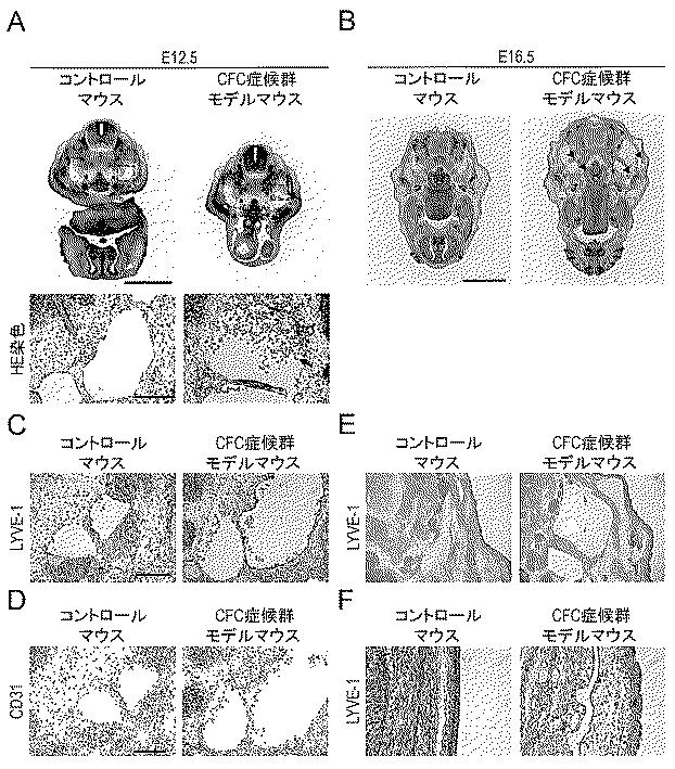 6429306-ＣＦＣ症候群モデルマウスの作製とその治療法の確立 図000016