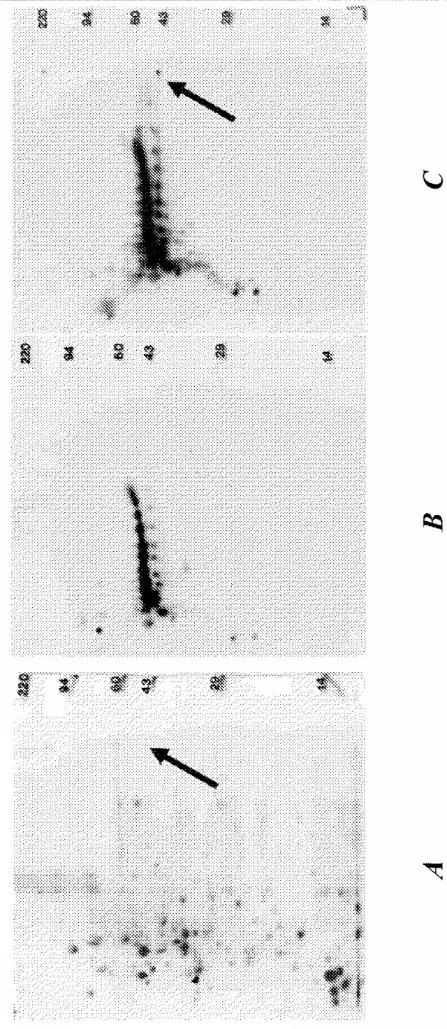 6559302-黄色ブドウ球菌（Ｓｔａｐｈｙｌｏｃｏｃｃｕｓ  ａｕｒｅｕｓ）感染症に対する抗グルコサミニダーゼ受動免疫処置 図000016