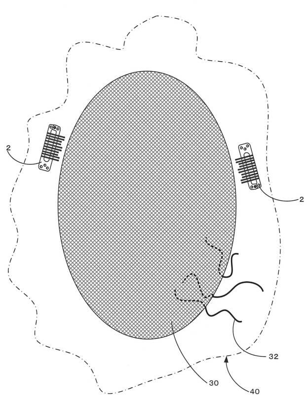 6789433-留め具 図000016