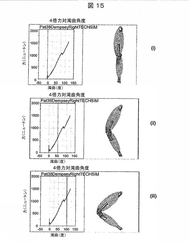 6979445-患者の関節用の整形外科インプラントの位置合わせをモデル化するためのコンピュータ装置の作動方法およびコンピュータ装置 図000016