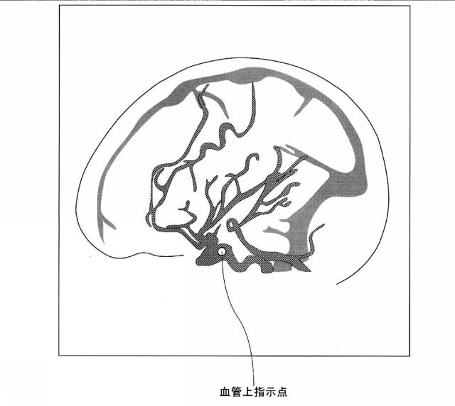 5835912-医用画像診断装置および医用画像処理装置 図000017