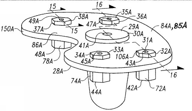 5916989-異なる質感を有する表面を備えた人工関節及びその人工関節の作製方法 図000017