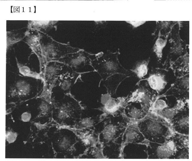 6072967-リン酸カルシウム焼結体粒子の製造方法 図000017