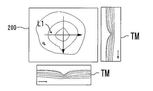 6241040-眼科解析装置、及び眼科解析プログラム 図000017