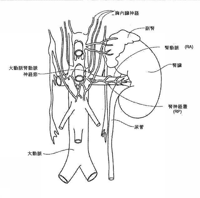 6267774-神経変調療法の評価及びフィードバックのためのデバイス、システム、及び方法 図000017