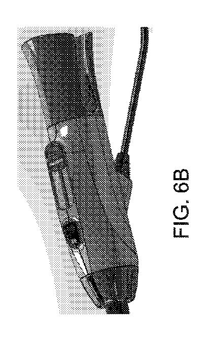 6283091-単一の内視鏡用管採取デバイス 図000017
