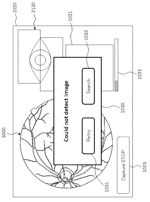 6321430-眼科装置 図000017