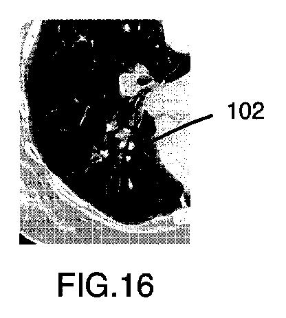 6396310-第一レンダリング投影と第二レンダリング投影との間のトランジションをユーザーに表示するための方法および装置 図000017