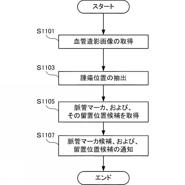 6544698-放射線治療用の脈管マーカ、脈管マーカの留置支援装置、放射線照射制御装置および放射線照射制御プログラム 図000017