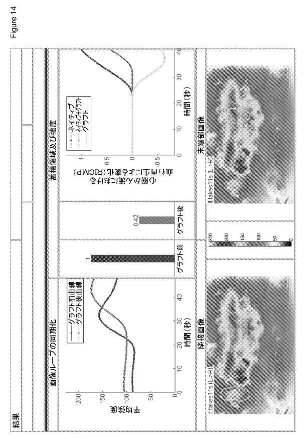 6561180-血管造影及びかん流の定量化並びに解析手法 図000017