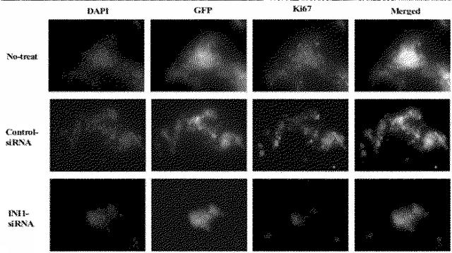 6609867-癌治療薬剤ならびに治療方法 図000017