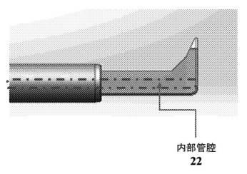 6815416-眼科ナイフ及び使用方法 図000017