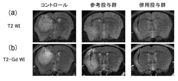 6952980-血管新生阻害薬 図000017