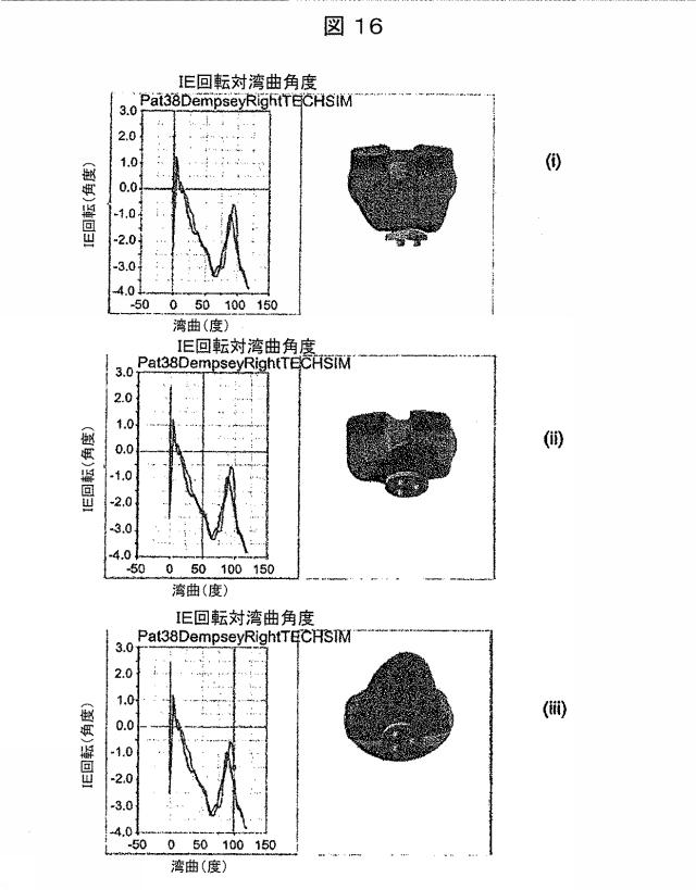 6979445-患者の関節用の整形外科インプラントの位置合わせをモデル化するためのコンピュータ装置の作動方法およびコンピュータ装置 図000017