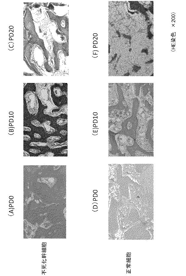 6010112-不死化幹細胞及びその産生物を有効成分とする医薬組成物並びに医薬製剤 図000018