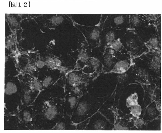 6072967-リン酸カルシウム焼結体粒子の製造方法 図000018