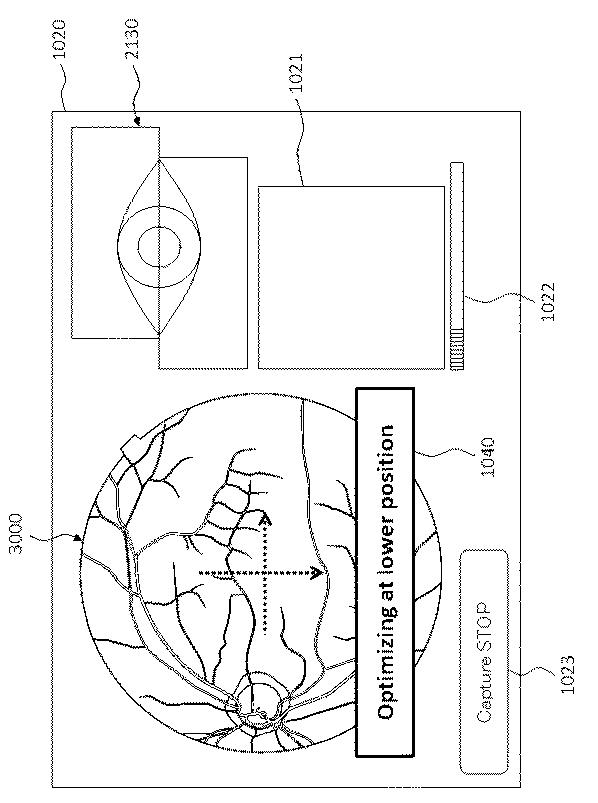 6321430-眼科装置 図000018