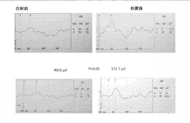 6425785-網膜中および／または網膜下における液体貯留の処置のための方法および組成物 図000018