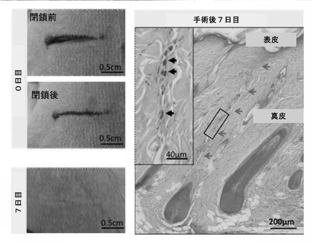 6437552-組織表面及び材料を接着する方法、並びにその生物医学的使用 図000018