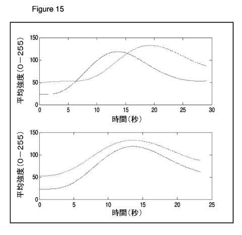 6561180-血管造影及びかん流の定量化並びに解析手法 図000018