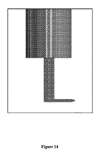 6815416-眼科ナイフ及び使用方法 図000018